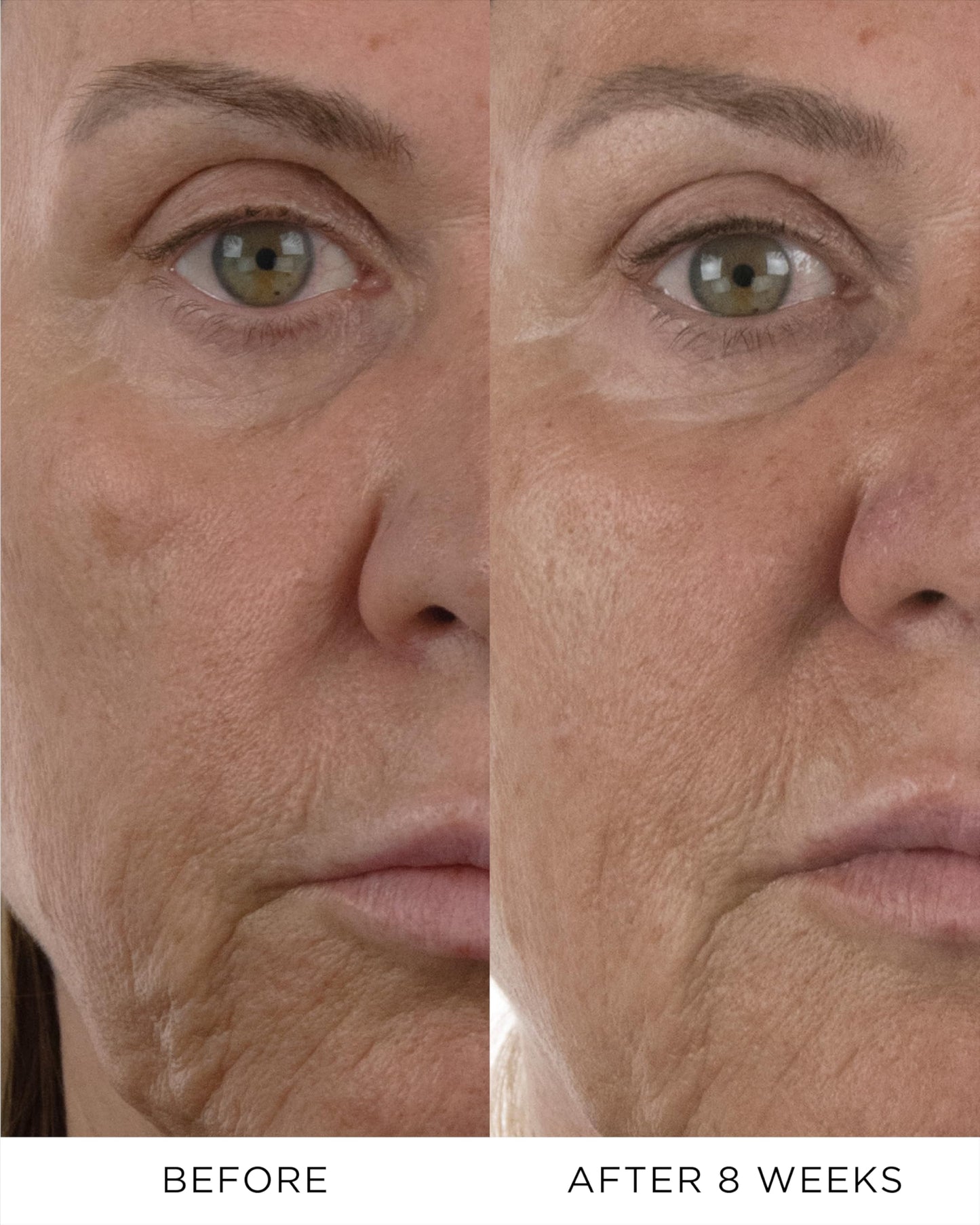 Absolute Intense Renewal Serum DOSE