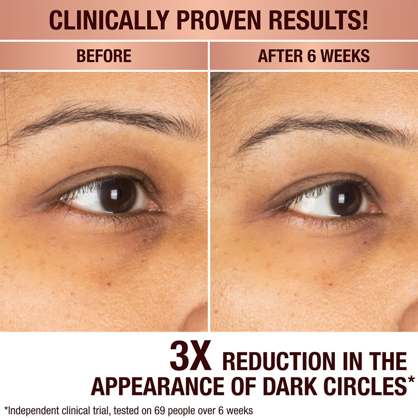 Charlotte Tilbury Radiance Recovery Dark Spot Serum - Tranexamic Acid & Vitamin C Serum for Brighter Looking Under Eyes, Redness, Uneven Skin Tone - Treatment to Reduce Appearance of Aging Skin
