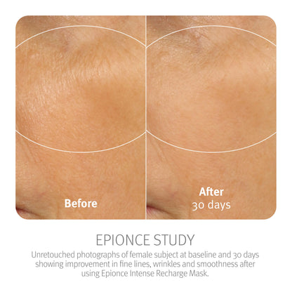 Epionce Intense Recharge Mask - Anti-Aging Clay Face Mask for All Skin Types, Hydrating Mask with Kaolin for the Skin Barrier, Dermatologist Skincare