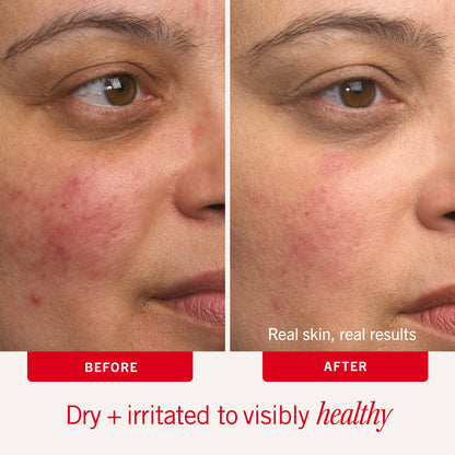 First Aid Beauty - Ultra Repair Cream - Hydrating Face & Body Moisturizer - Whipped Colloidal Oatmeal Clinically Proven to Strengthen Skin Barrier in 7 Days - Helps Relieve Eczema, 6oz Plus 1oz Tube
