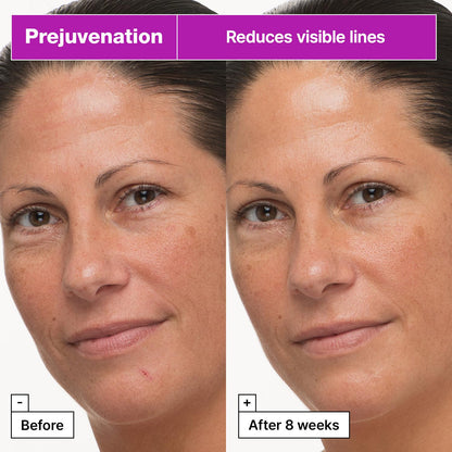 Dr.Jart+ Prejuvenation Firming Bakuchiol Cream with Collagen Peptides | Korean Anti Aging Face Cream | Sensitive Skin Friendly | Korean Skin Care, 1.69 Fl Oz