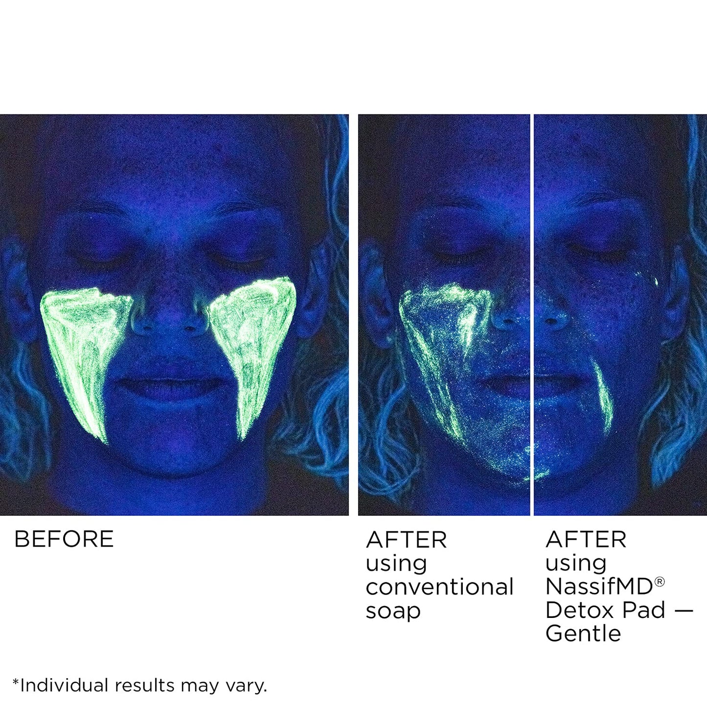 NassifMD Gentle Detox Pads, Surgeon-Created Fruit Acid Complex for Sensitive Skin, Brightens, Exfoliates & Reduces Wrinkles, Dermatologist-Tested
