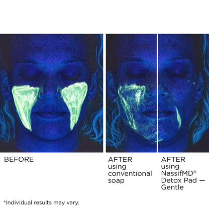 NassifMD Gentle Detox Pads, Surgeon-Created Fruit Acid Complex for Sensitive Skin, Brightens, Exfoliates & Reduces Wrinkles, Dermatologist-Tested
