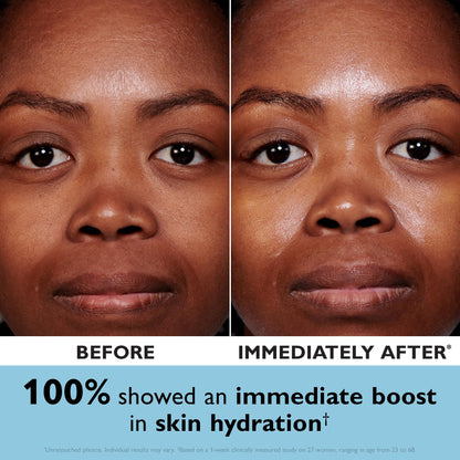 Peter Thomas Roth | Water Drench® Hyaluronic Cloud Cream | Hydrating Moisturizer for Face, Up to 72 Hours of Hydration for More Youthful-Looking Skin, Fragrance Free
