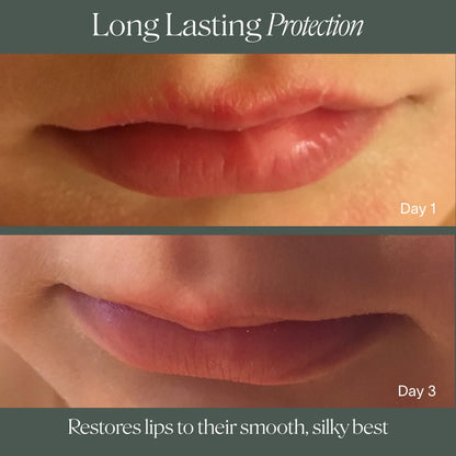 Doctor Rogers Lip Balm. Hydrating & Softening Lip Moisturizer for Very Dry Lips, Natural & Hypoallergenic, 0.15 Ounce (4.25 g) Tube