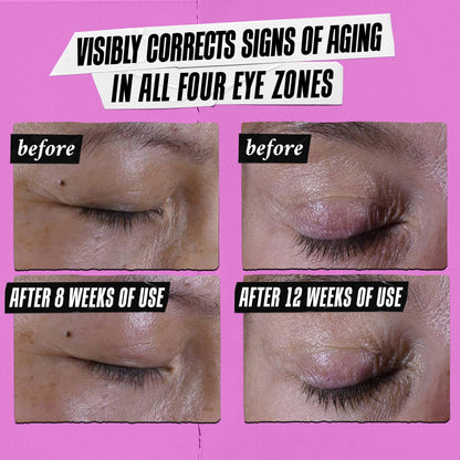 Kiehl's Super Multi-Corrective Eye Cream, Anti-Aging Cream that Lifts Brow Bone Area, Smooths and Firms Eye Lids, Bilberry Seed Extract and Collagen Peptide for Tighter and Smoother Looking Skin