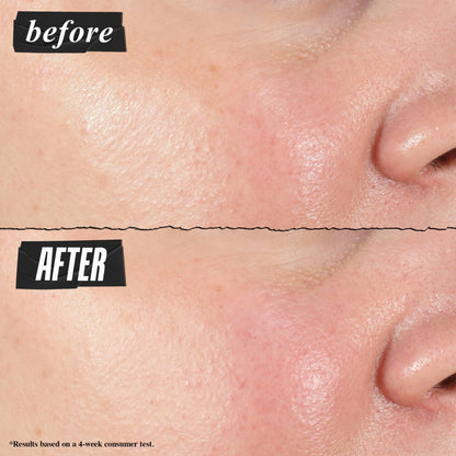 Kiehl's Hydro-Plumping Hydrating Serum, Plumps Skin, Improves Elasticity, Reduces Appearance of Dry Skin, Ophthalmologist and Dermatologist Tested, Fragrance-Free