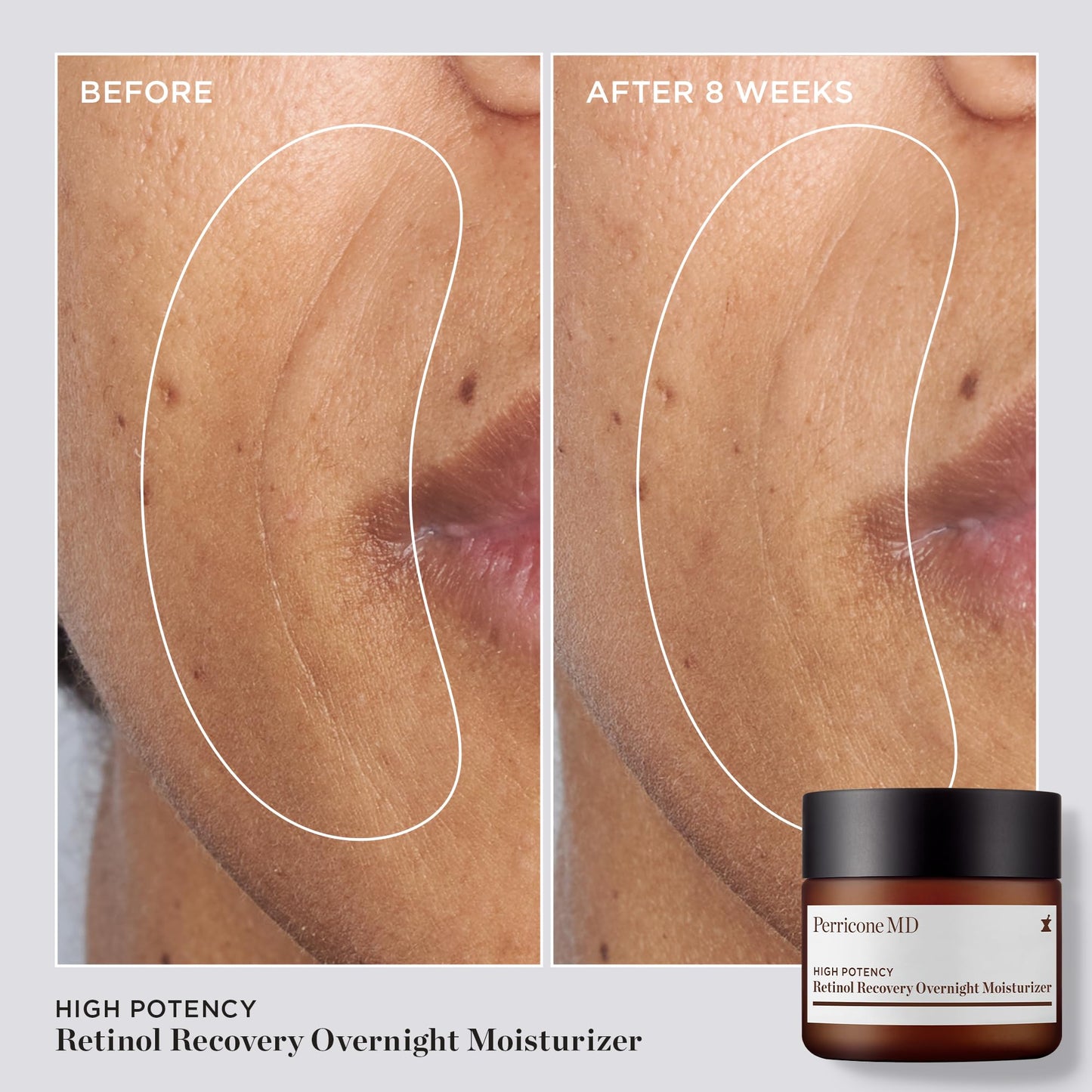 High Potency Classics Retinol Recovery Overnight Moisturizer