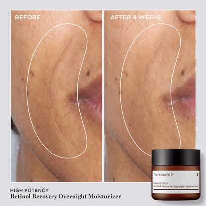 High Potency Classics Retinol Recovery Overnight Moisturizer