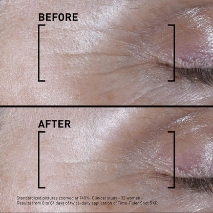 Filorga Time-Filler Shot, A Moisturizing Serum with Neuropeptide Technology & Polysaccharides to Relax Expression Lines, Hydrate, & Firm Skin for Visible Results in 7 Days, 0.5 fl. Oz.