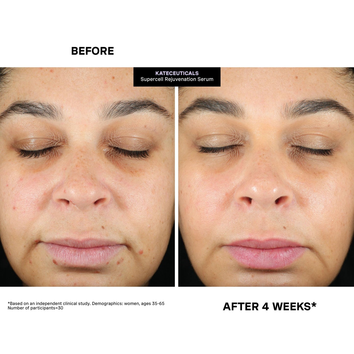 Kate Somerville KateCeuticals® SuperCell – Rejuvenation Peptide Serum to Repair Damaged Skin and Reduce Fine Lines and Wrinkles, 1 Fl Oz
