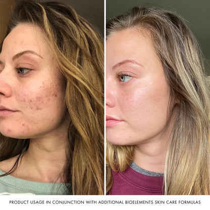 Bioelements RayDefense - 4 fl oz - Hydrating Broad-Spectrum SPF 30 Sunscreen & Moisturizer for All Skin Types - Vegan, Gluten Free - Never Tested on Animals