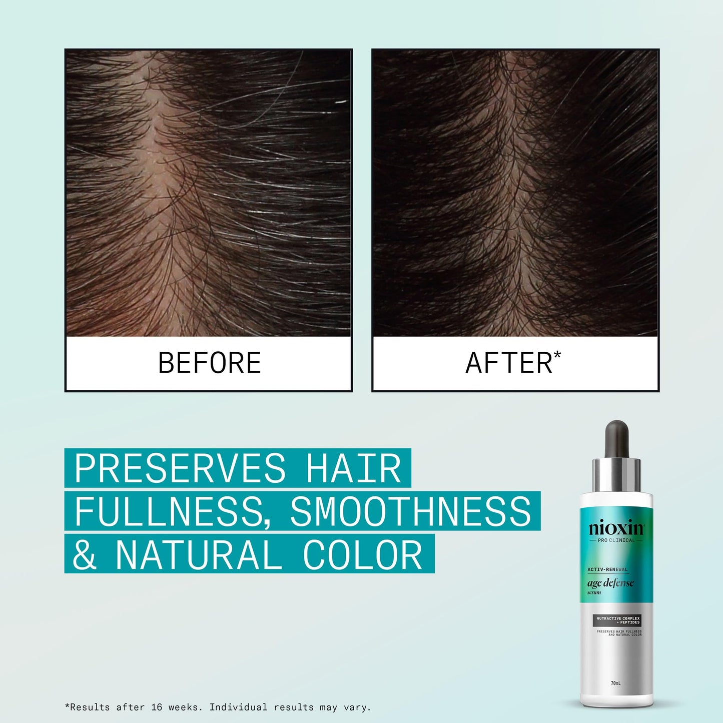 Nioxin Age Defense Anti Aging Kit | Activ-Renewal Regimen Detox Scalp Cleanser, Strengthening Conditioner, Leave-in Scalp Treatment | 5.5 Fl Oz