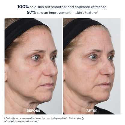 M-61 PowerGlow Peel Extra Strength 20% | Professional Strength Exfoliating Facial Peel With Advanced 20% Glycolic Acid