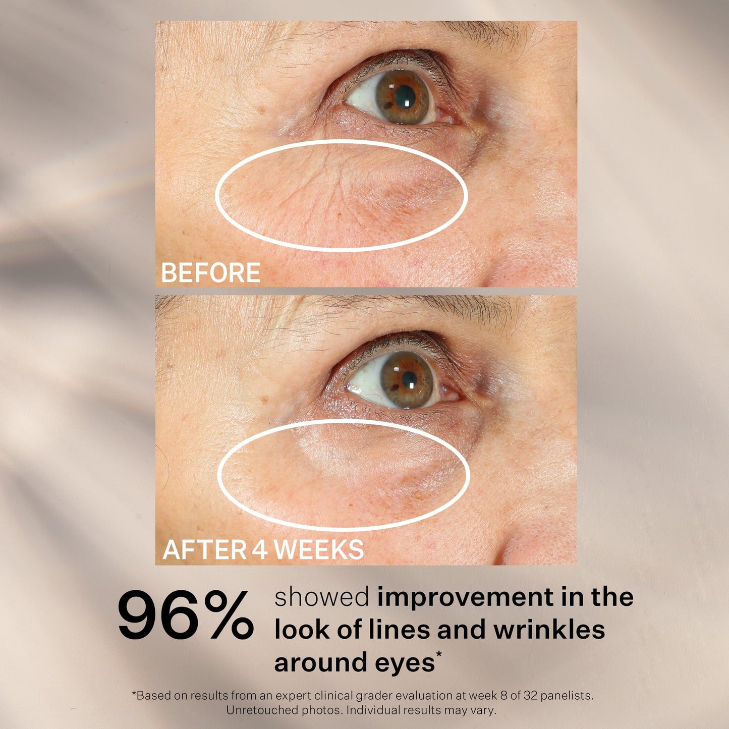 StriVectin Tighten & Lift Peptight Face Lift Serum with Tightening & Brightening Peptides for Wrinkles