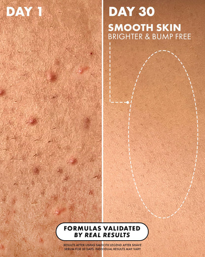 Truly Luxury After Shave Serum | Soothing & Hydrating Post Shave Treatment to Prevent Ingrown Hair For Smooth, Irritation-Free Skin