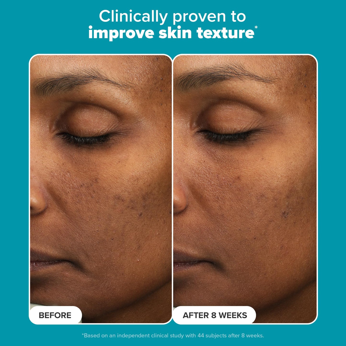 Paula’s Choice 6% Mandelic Acid + 2% Lactic Acid Exfoliant, Gentle Daily AHA Exfoliation for Discoloration, Bumpy Texture & Radiance, for Sensitive Skin, Fragrance-Free