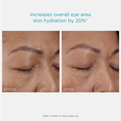 NEOSTRATA RESTORE Hydra Filling PHA Eye Cream, Hydrating and Lifting Anti-Aging Eye Treatment for Fine lines & Wrinkles with Hyaluronic Acid, Vitamin C& E, and Green Tea Extract, 0.5oz