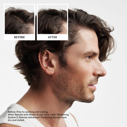 Nioxin Scalp + Hair Thickening System 2 Conditioner| For Natural or Untreated Hair with Progressed Thinning| With Niacinamide and Biotin | 33.8 Fl oz.