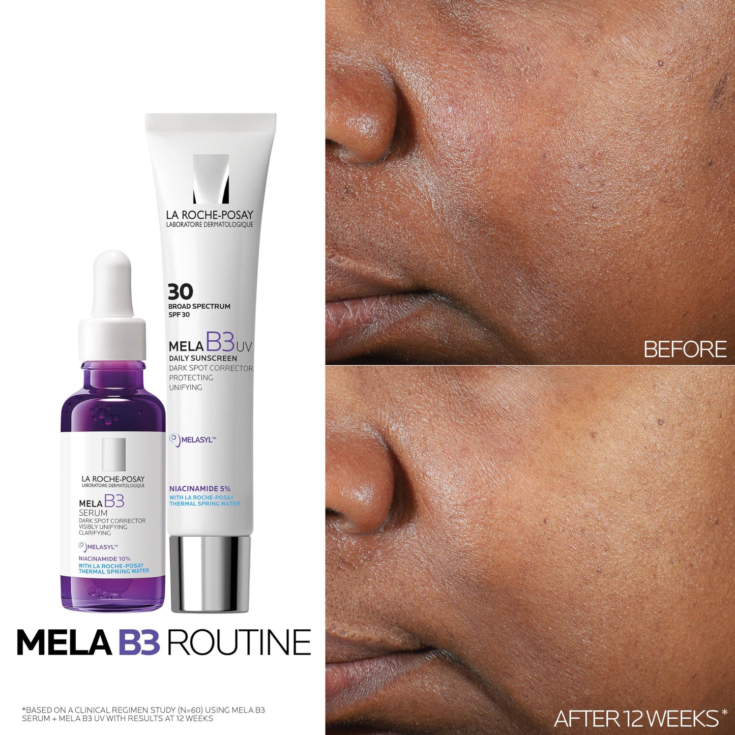 La Roche-Posay Mela B3 UV Daily Sunscreen, Face Moisturizer With SPF 30 + Anti-Aging Melasyl + 5% Niacinamide, Helps Correct & Protect From Sun Damage, Face Sunscreen With No White Cast, 40ML