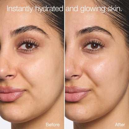 Clinique Moisture Surge Intense 72H Lipid-Replenishing Hydrator Face Moisturizer With Aloe Water + Cica | Hydrating + Moisturizing