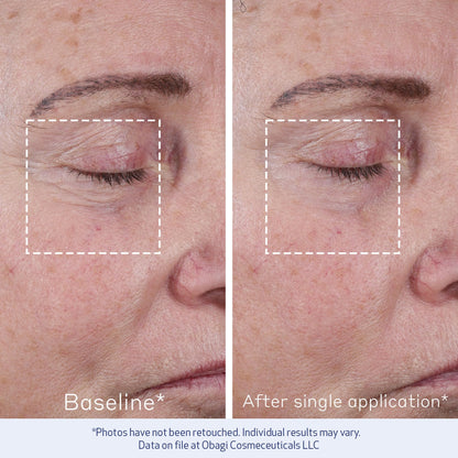 Obagi ELASTIderm Advanced Filler Concentrate – Clinically Proven Non-Injectable Filler with Biomimetic Peptide Technology that Firms Skin & Reduces the Appearance of Fine Lines & Wrinkles