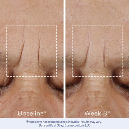 Obagi ELASTIderm Advanced Filler Concentrate – Clinically Proven Non-Injectable Filler with Biomimetic Peptide Technology that Firms Skin & Reduces the Appearance of Fine Lines & Wrinkles