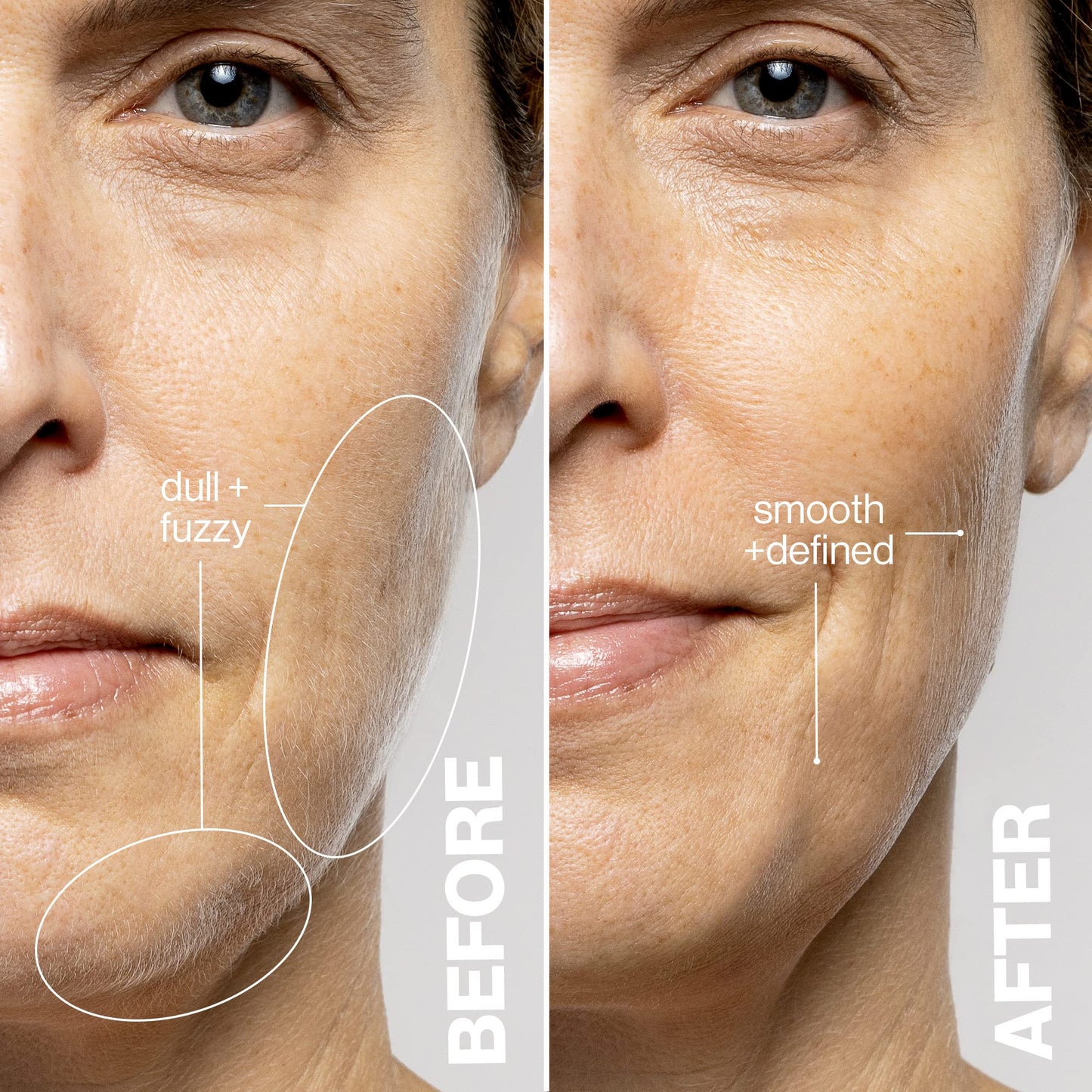 DERMAFLASH LUXE+ Sonic Dermaplaning Tool for Face Peach Fuzz Removal, Anti-Aging and Exfoliation