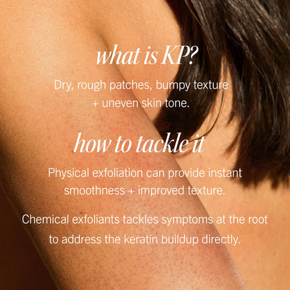 First Aid Beauty - KP Bump Eraser Body Scrub with 10% AHA, Keratosis Pilaris Exfoliator with Glycolic and Lactic acids, Helps Reduce Chicken Skin Bumps, Safe for Sensitive Skin, Strawberry Scent, 8 oz