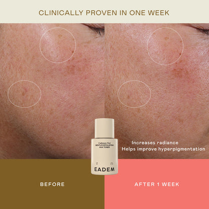 EADEM Gentle Exfoliating AHA & PHA Toner, Milky Rice Toner Exfoliant with Lactic, Azelaic, & Tranexamic Acid, Rice Water AHA Exfoliator & Pore Minimizer for Face and Body, 5.0 oz, Cashmere Peel