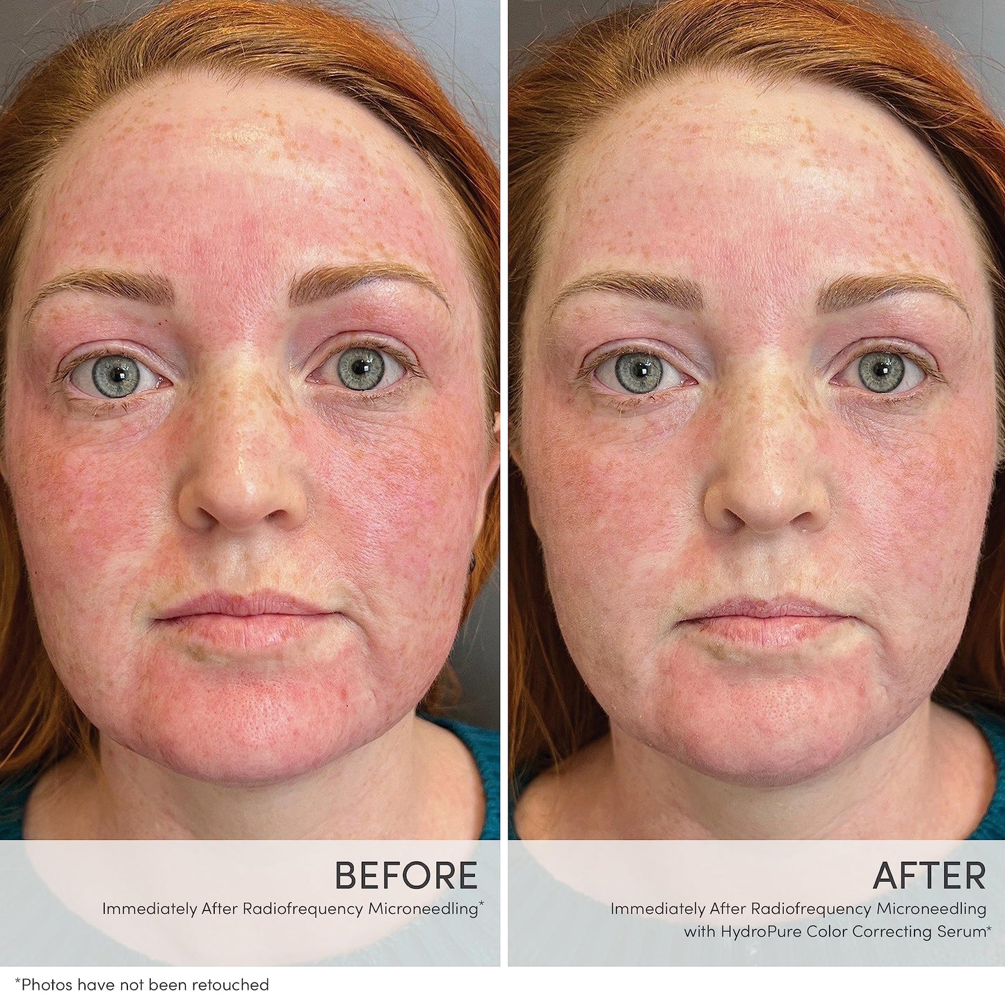 jane iredale HydroPure Tinted Serum, Hydrating, Sheer-Coverage Formula Helps Plump, Soothe, Blur Lines and Even Skin Tone with Hyaluronic Acid + CoQ10