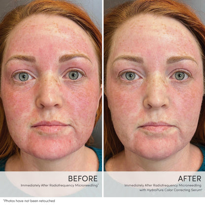 jane iredale HydroPure Tinted Serum, Hydrating, Sheer-Coverage Formula Helps Plump, Soothe, Blur Lines and Even Skin Tone with Hyaluronic Acid + CoQ10