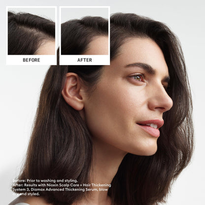 Nioxin Scalp + Hair Thickening System Kits | For Natural, Colored, & Damaged Hair with Light to Progressed Thinning | Strengthen & Boost Hair Density with Niacinamide & Biotin | 3 Month Supply