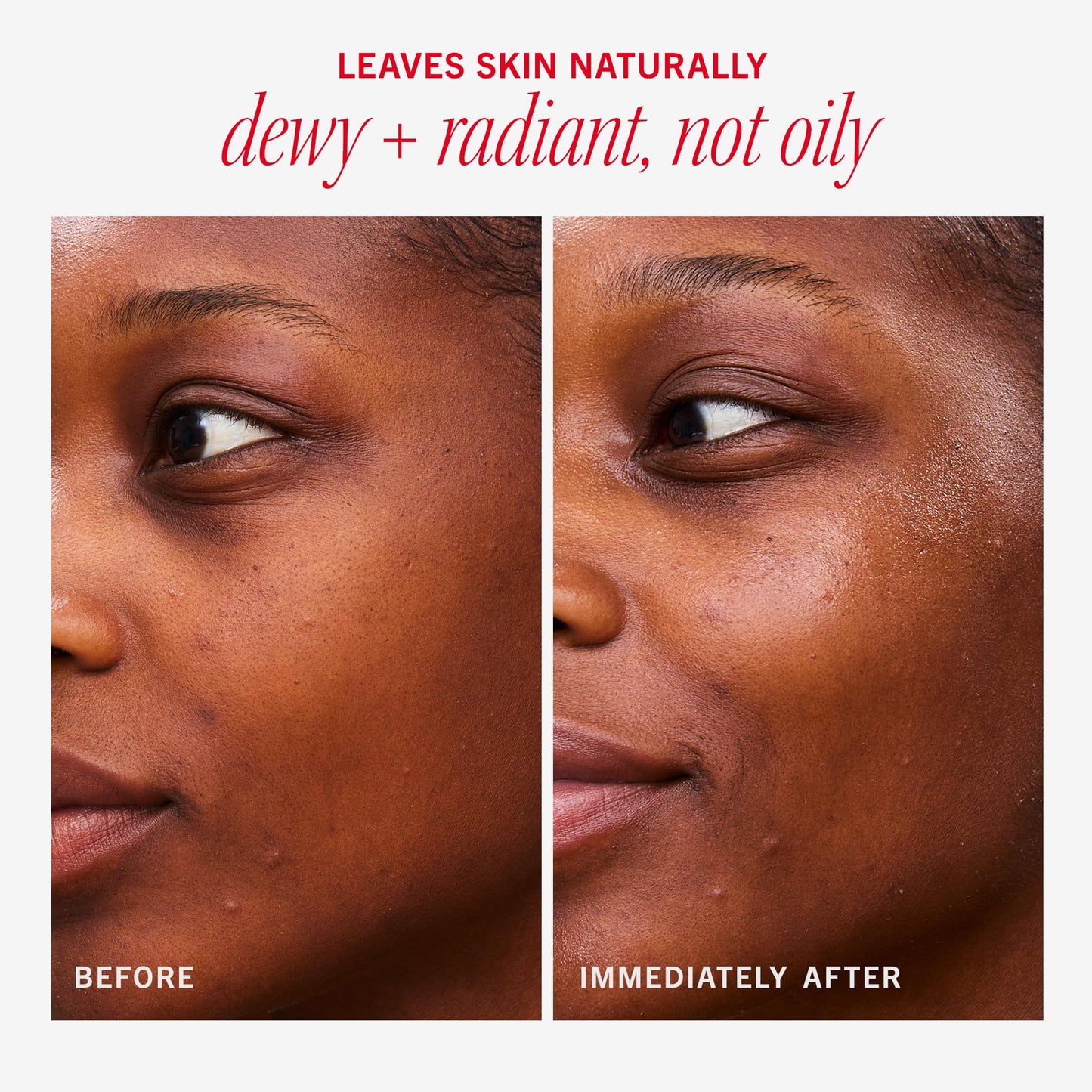 First Aid Beauty - Hydrating Dewy Gel Cream, Lightweight Oil-Free Facial Moisturizer with Hyaluronic Acid and Ceramides, Helps Reduce Excess Oil Build Up & Improve Skins Hydration, 1.9 FL oz