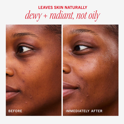 First Aid Beauty - Hydrating Dewy Gel Cream, Lightweight Oil-Free Facial Moisturizer with Hyaluronic Acid and Ceramides, Helps Reduce Excess Oil Build Up & Improve Skins Hydration, 1.9 FL oz