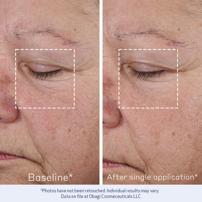 Obagi ELASTIderm Advanced Filler Concentrate – Clinically Proven Non-Injectable Filler with Biomimetic Peptide Technology that Firms Skin & Reduces the Appearance of Fine Lines & Wrinkles