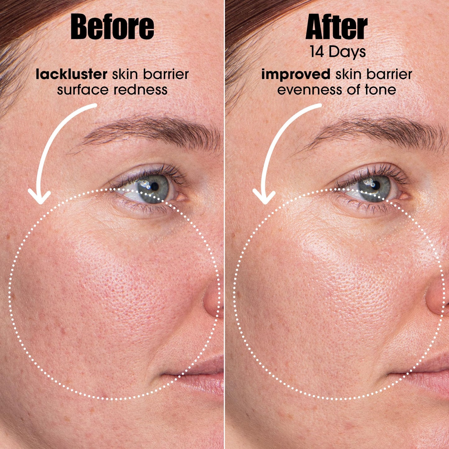 Sunday Riley A.I. Adaptive Retinoid Serum For Blemish Prone Skin