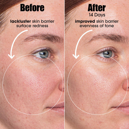 Sunday Riley A.I. Adaptive Retinoid Serum For Blemish Prone Skin