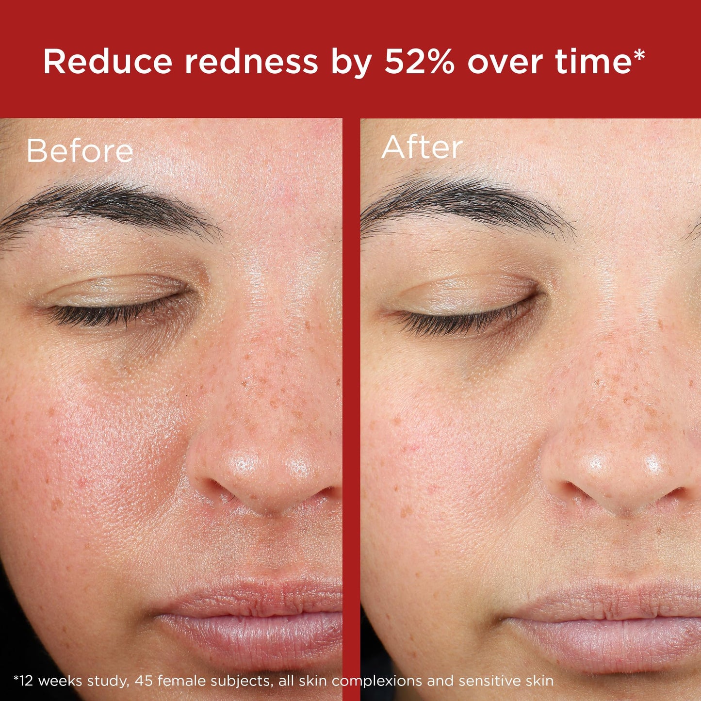 EltaMD UV Skin Recovery Face Sunscreen with Zinc Oxide, All Mineral, Safe for Sensitive Skin SPF 50