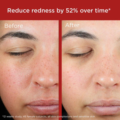 EltaMD UV Skin Recovery Face Sunscreen with Zinc Oxide, All Mineral, Safe for Sensitive Skin SPF 50