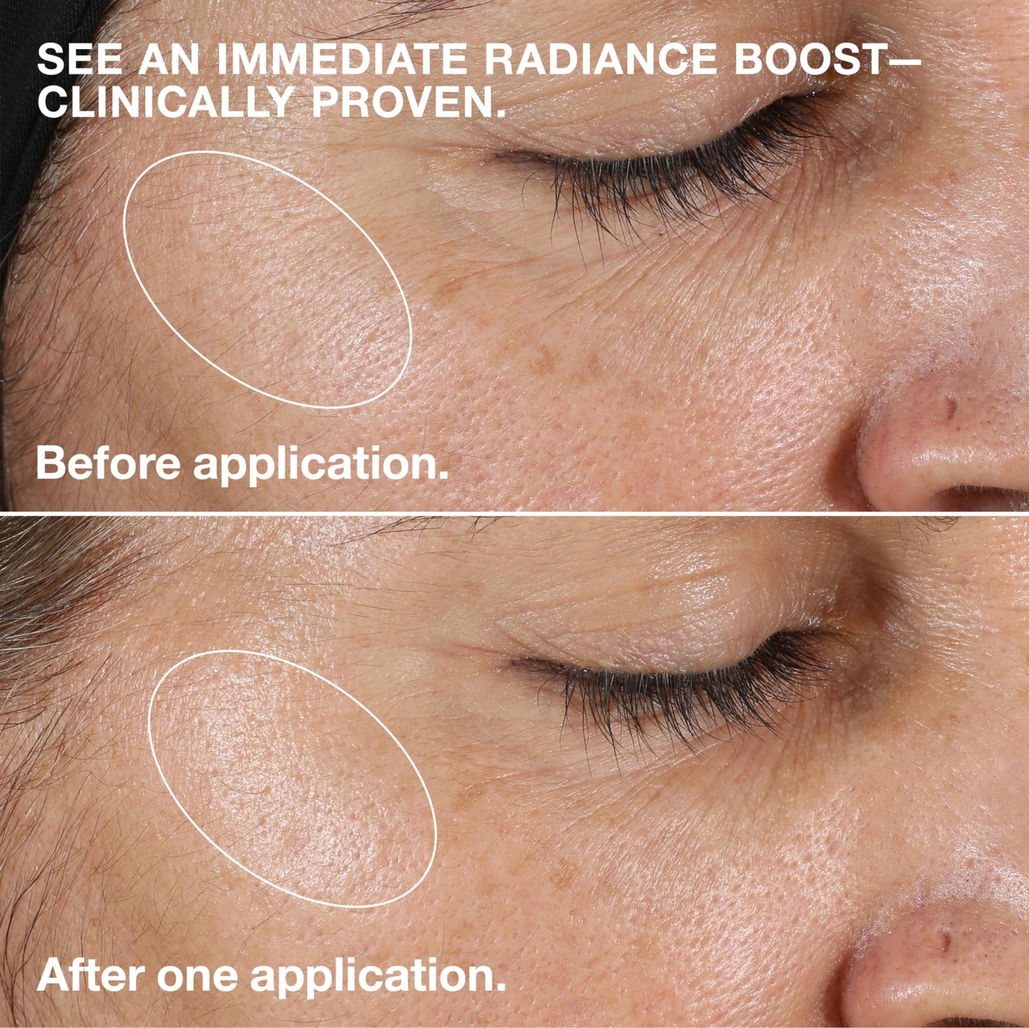 Clinique 3-Step Clarifying Lotion Face Exfoliator 2 | Toner With Witch Hazel | For Dry Combination Skin Types