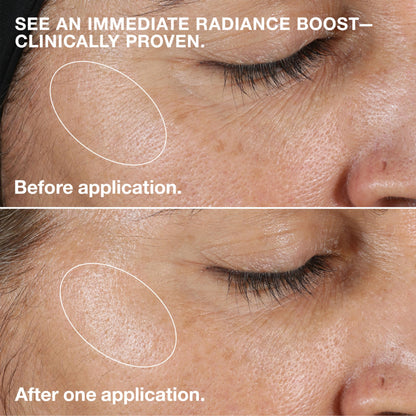 Clinique 3-Step Clarifying Lotion Face Exfoliator 2 | Toner With Witch Hazel | For Dry Combination Skin Types