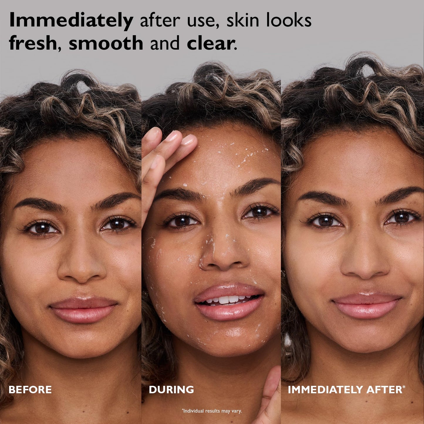Peter Thomas Roth | FIRMx® Peeling Gel | Gentle Facial Exfoliant for Dullness, Pores and Uneven Texture