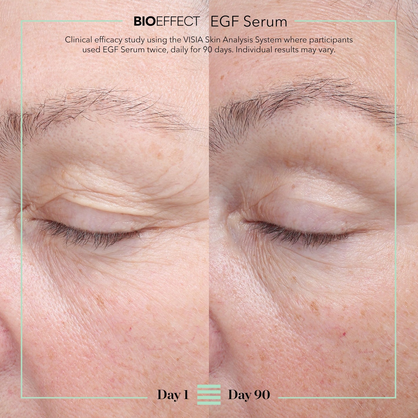 BIOEFFECT EGF Serum | Epidermal Growth Factor + Hyaluronic Acid | Age-Defying Face Treatment for Fine Lines & Wrinkles, Hydration & Firmness, 20 mL / 0.68 oz
