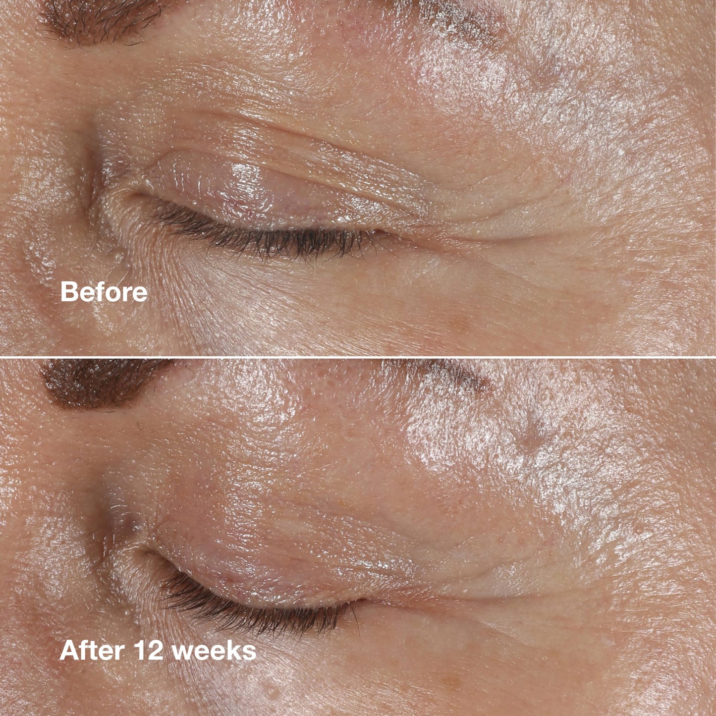 Clinique Smart Clinical Repair Wrinkle Correcting Eye Cream With Hyaluronic Acid + Peptides | Anti-Aging, Hydrating + Depuffing